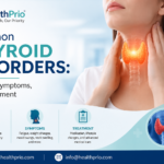 Common Thyroid Disorders: Causes, Symptoms, and Treatment