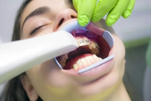 Dental Treatments Body Image