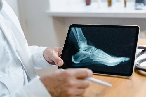 Orthopedic Procedures Body Image